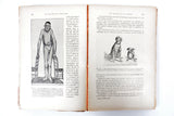 Antique Illustrated Medical Book, Genetic Diseases & Disorders, Dr Libert, Paris